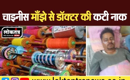 बैतूल चाइनीस माझे से बाइक सवार  डॉक्टर की कटी नाक