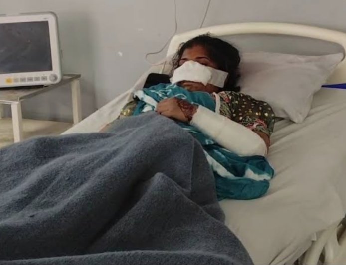 झाबुआ दिल दहलाने वाला मामला नशे में पत्नी की नाक काटी